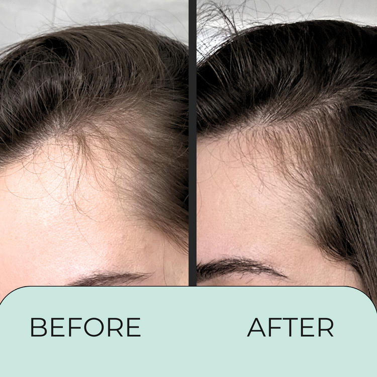 before and after hair edge growth