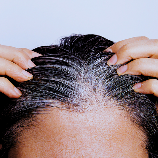 woman touching her thinning hair due to hair loss from stress