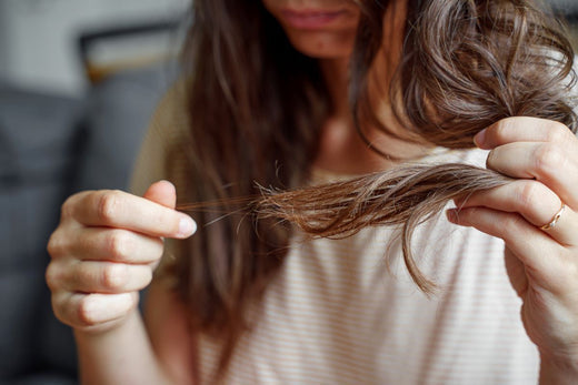 woman suffering from Telogen Effluvium hair loss